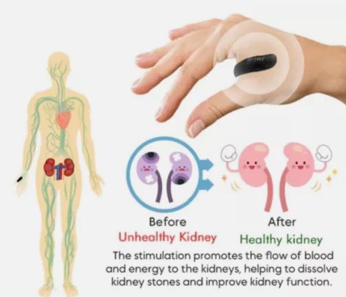Acupressure Point Clip (Magnetic)